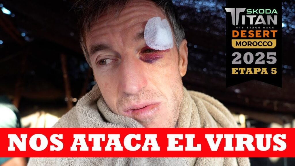 Nos ataca el virus Etapa 5 Skoda Titan